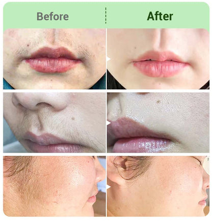BUY 2 GET 3 FREE🤩Hair Removal Cream Kit for Women🤩