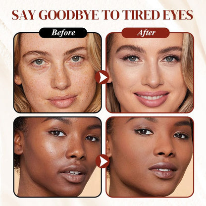 💥BUY 2 GET 1 FREE 💝✨ Last Day Special Sale ✨Magic Under-Eye Corrector3