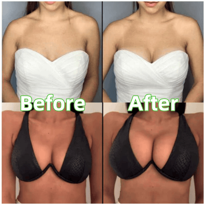 🔥Hot Sale 49% OFF🔥Ultra Boost Inserts || Patented Sticky Fashion Bra Inserts