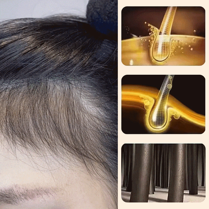 🍀Polygonum Shampoo Soap, Cleansing Hair & Face