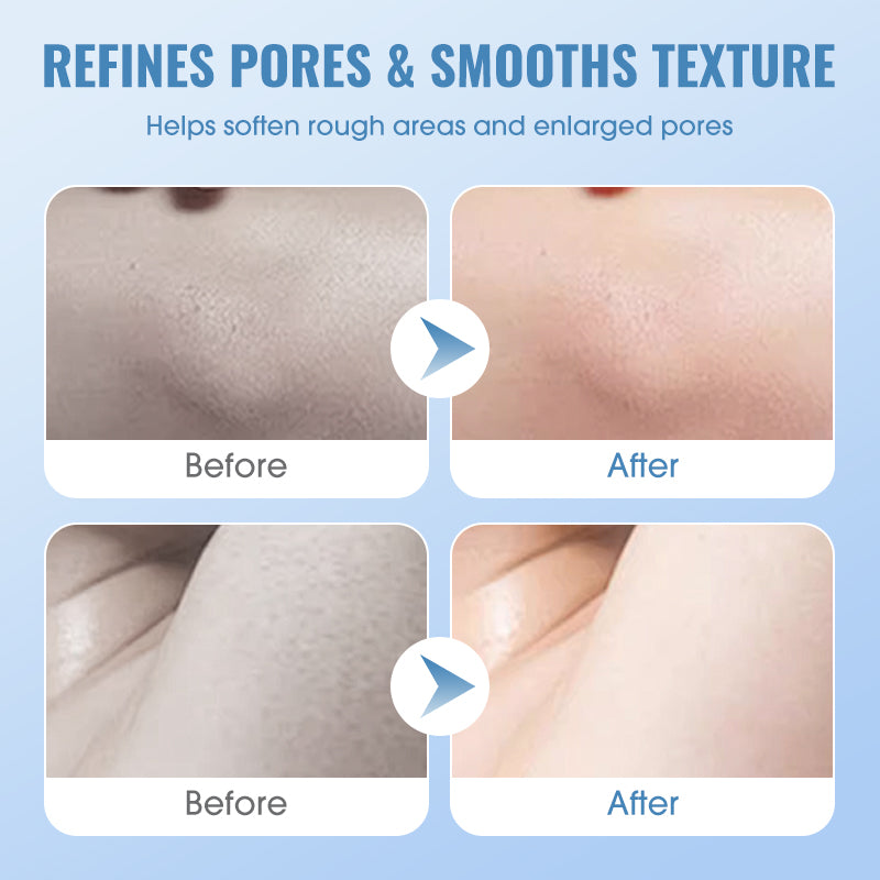 💕Gentle Deep Cleansing Exfoliating Gel