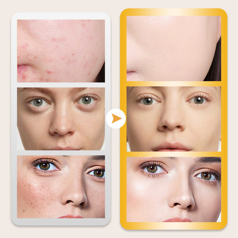 📢📢Buy 1 Get 1 Free⏰SPF50+ Snail BB Cream - All in One